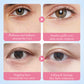 UnderGlow™ Collagen Teardrop Pads