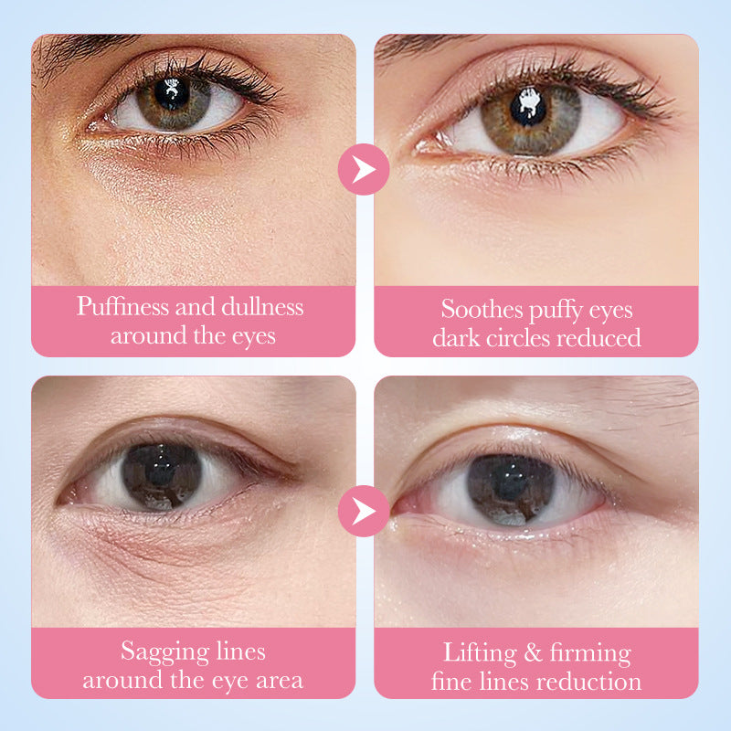 UnderGlow™ Collagen Teardrop Pads